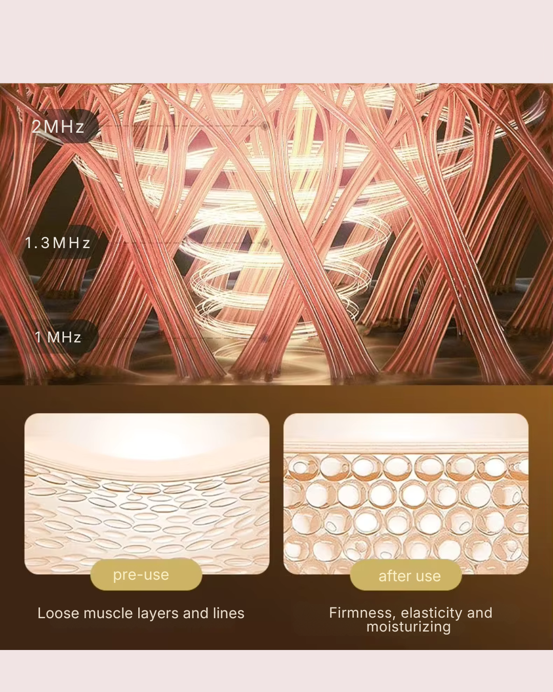 High-frequency vibrations ||| High-frequency vibrations evenly and continuously stimu-
late muscle activity Unclogs meridians and soothes neck muscles