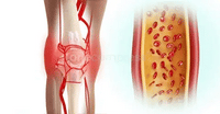 Knee Support Sleeve with strap 1pc